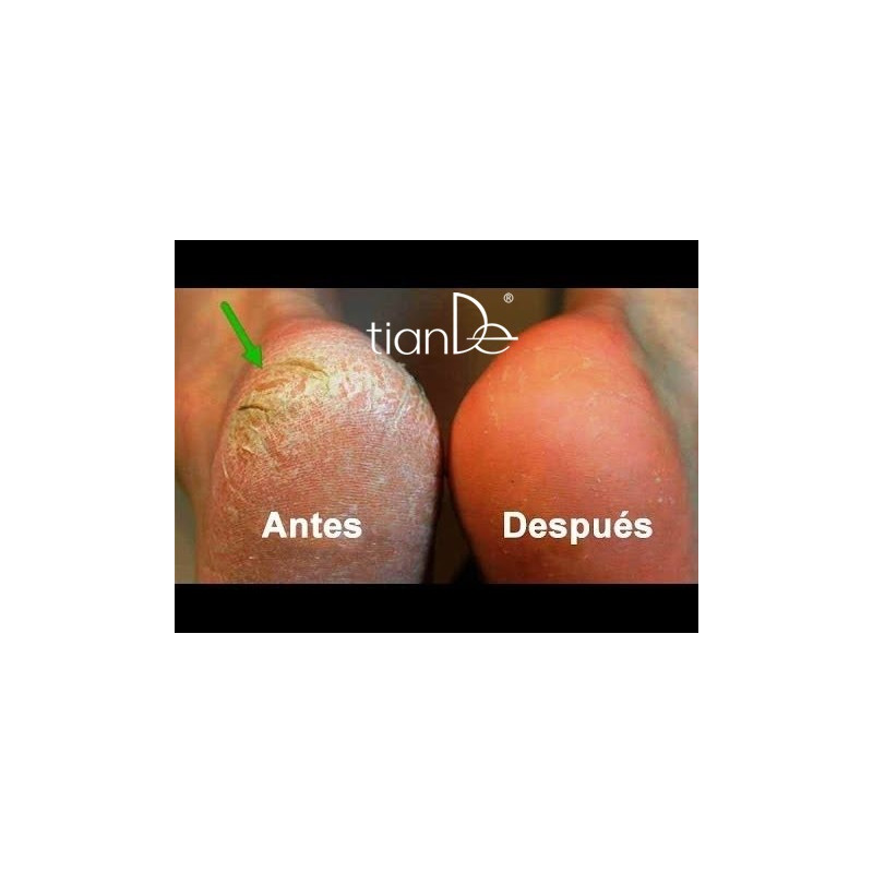 Crema Regeneradora Multifuncional para Callos y Durezas con Aceite de Serpiente.