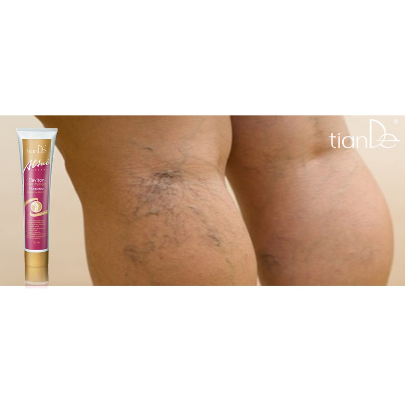 Gel de Masaje Anti-inflamatorio para Eliminar Varices y Piernas Cansadas Slaviton.